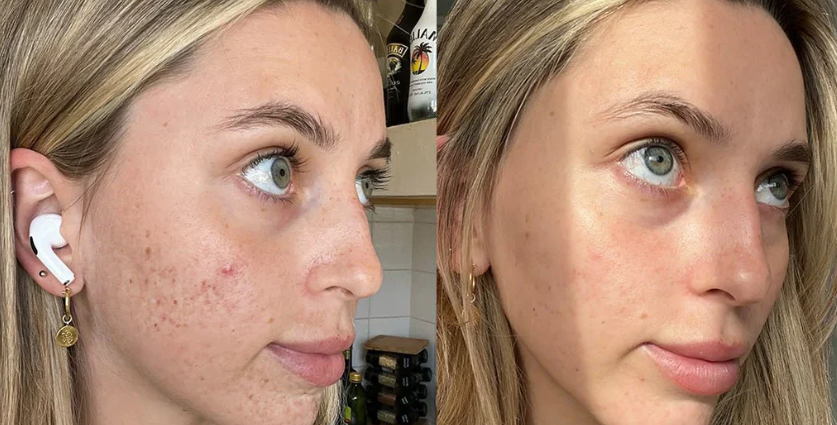 Glass Skin Collagen Pumping Serum | Last 3 Hours 50% Off!