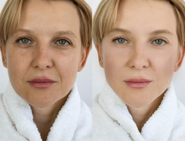 Glass Skin Collagen Pumping Serum | Last 3 Hours 50% Off!