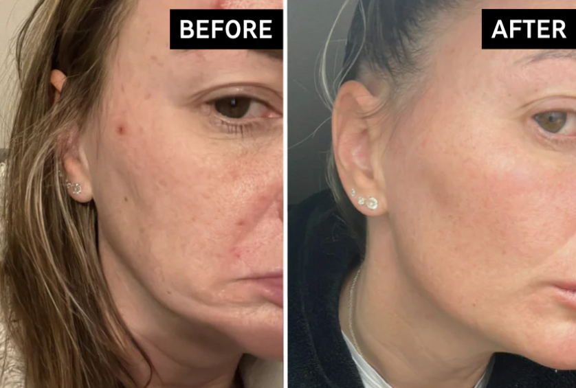 Glass Skin Collagen Pumping Serum | Last 3 Hours 50% Off!