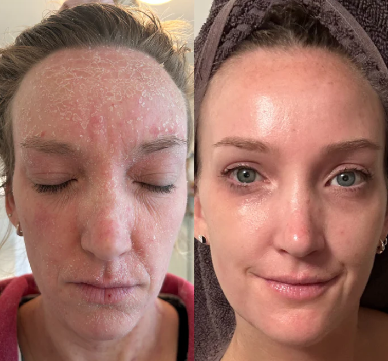 Glass Skin Collagen Pumping Serum | Last 3 Hours 50% Off!