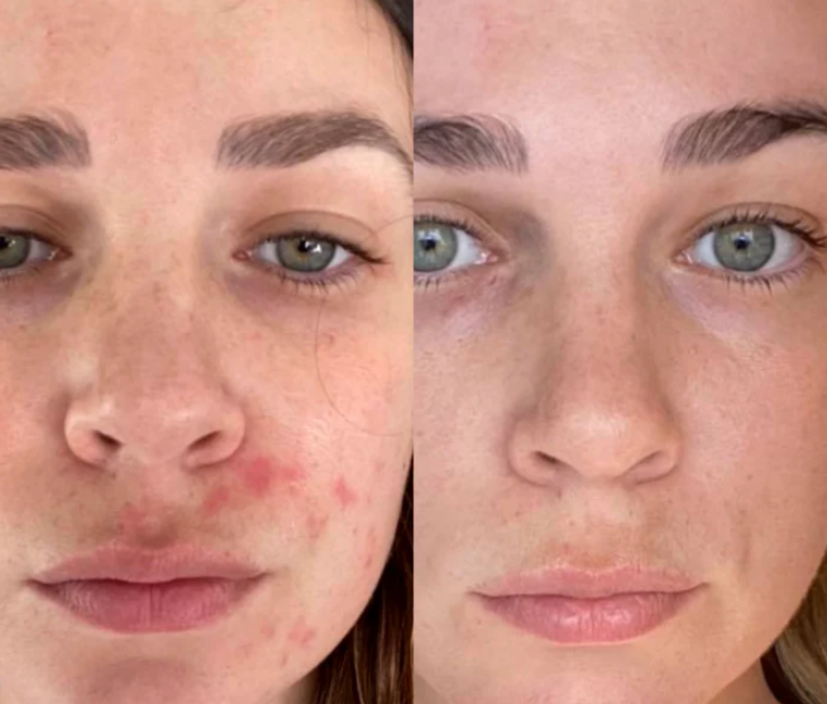 Glass Skin Collagen Pumping Serum | Last 3 Hours 50% Off!