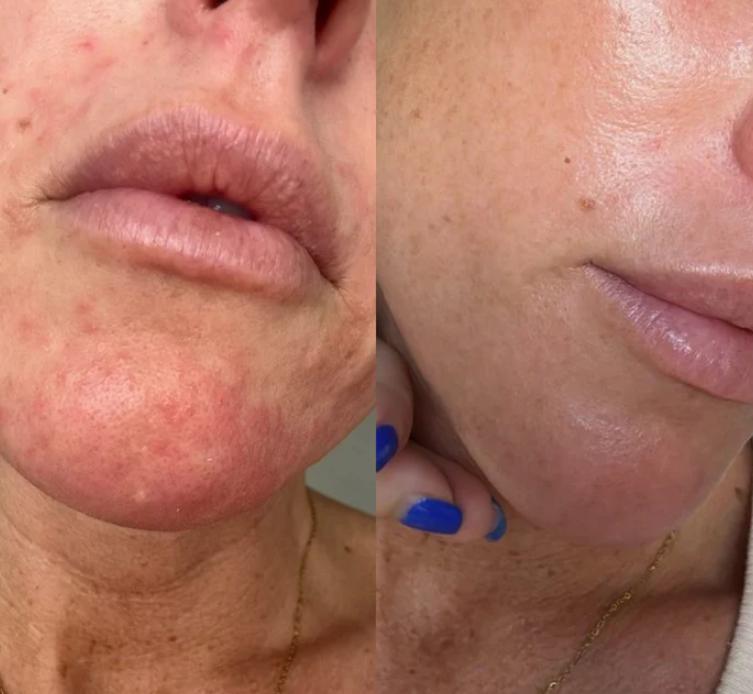 Glass Skin Collagen Pumping Serum | Last 3 Hours 50% Off!