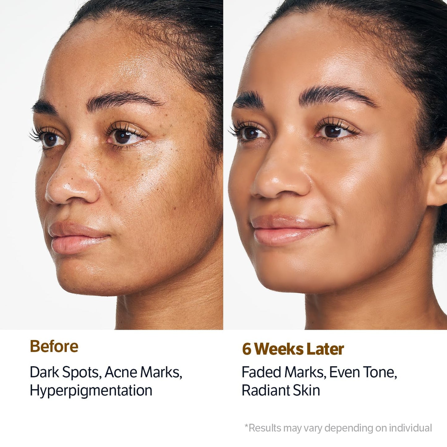 Glass Skin Collagen Pumping Serum | Last 3 Hours 50% Off!