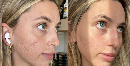 Glass Skin Collagen Pumping Serum | Last 3 Hours 50% Off!