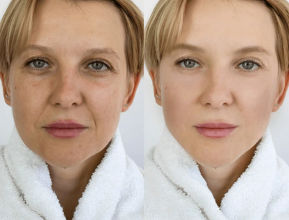 Glass Skin Collagen Pumping Serum | Last 3 Hours 50% Off!